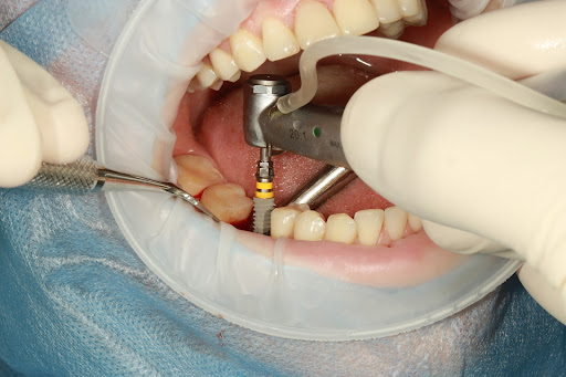 Image-2