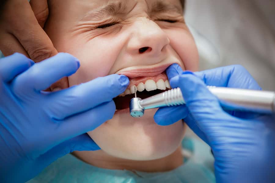 contactless-cavity-filling