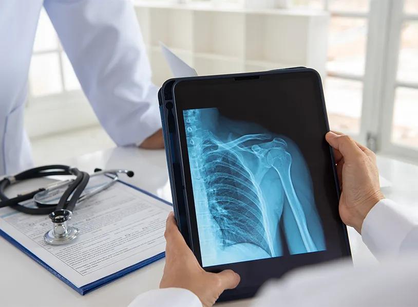 digital-x-ray-2