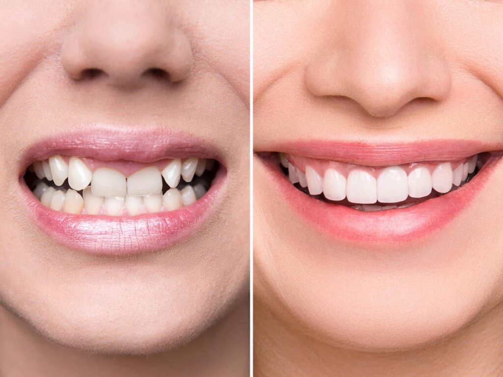 teeth-2-1024x768